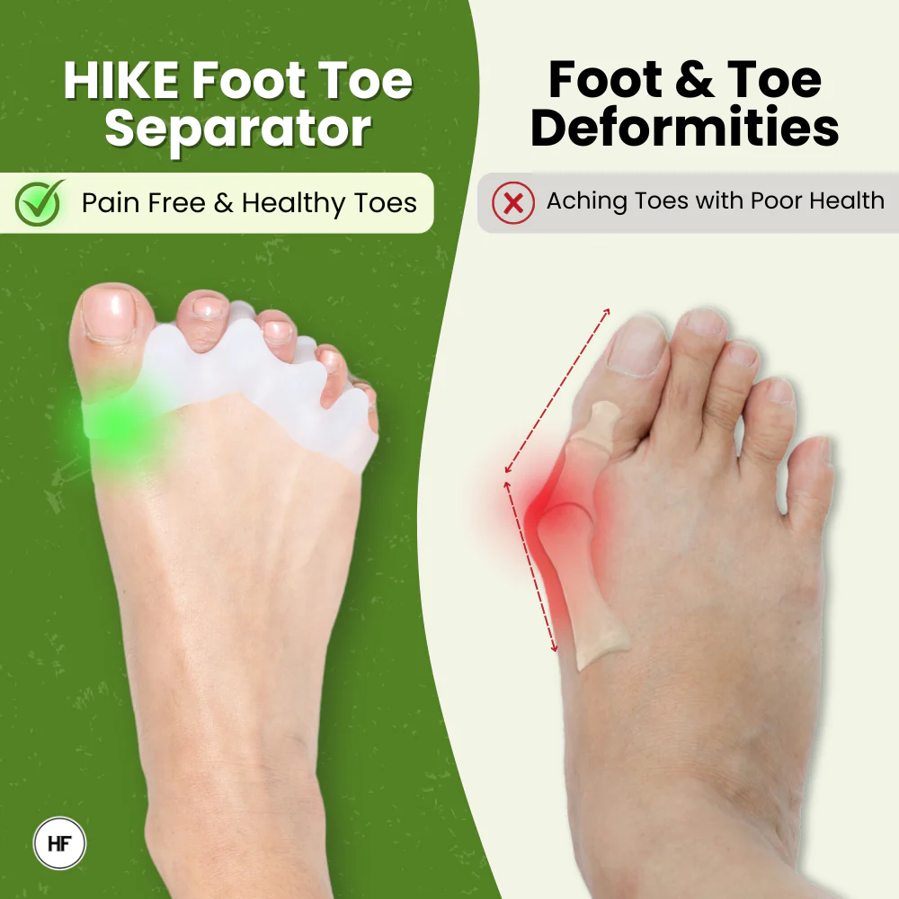 HIKE Foot Toe Separator - Achieve Healthy Toes, Correct Bunions, Hammer Toes, and Relieve Foot Pain - 图片 3